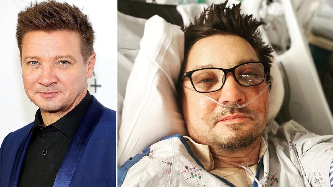 Marvel’s Hawkeye, Jeremy Renner Posts First Selfie After Snow Plow Accident On Instagram