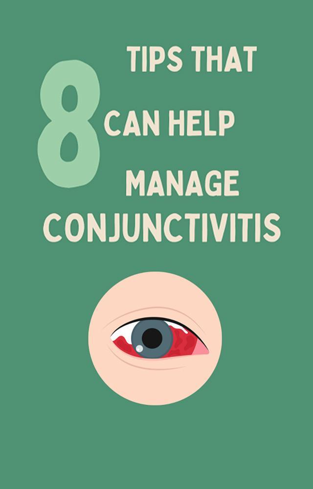Tips that can help manage Conjunctivitis