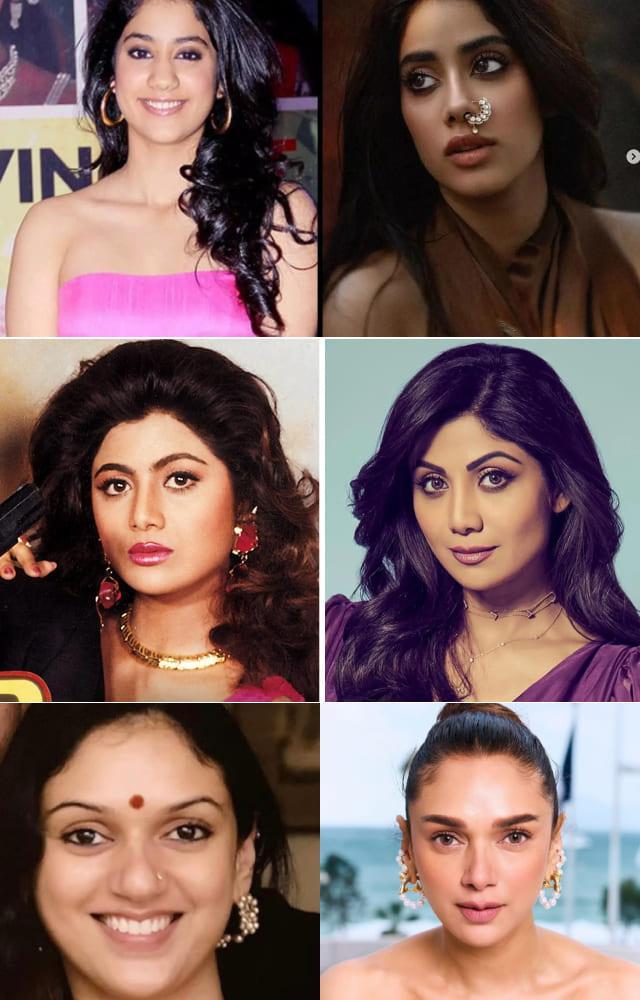 7 Actresses Who Had A Nose Surgery