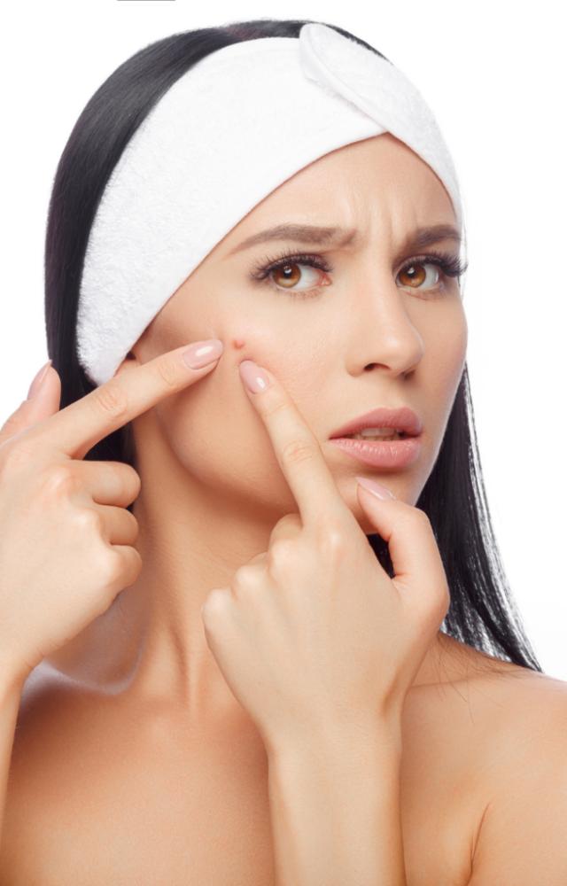 Popping pimples or picking at blemishes can cause scars and infections. It worsens inflammation and delays healing, harming your skin`s texture.