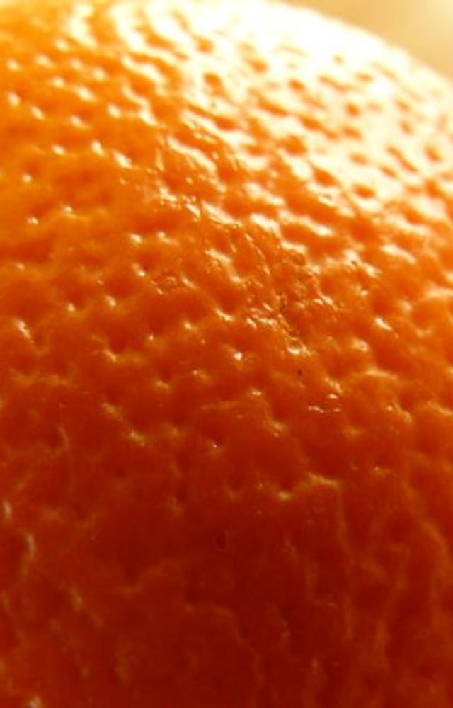 The skin of the breast may become dimpled, puckered, or look like the peel of an orange. This is called peau d`orange.