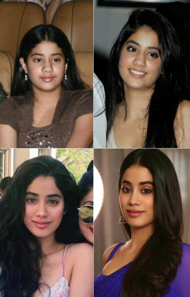 Following her mother`s footsteps, Janhvi Kapoor recently underwent a rhinoplasty, which has taken the internet by storm since it`s illegal in India.