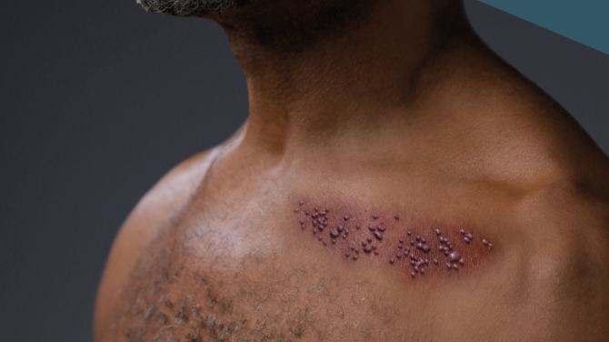 5 Common Causes of Chest Pain That Aren`t Heart Attacks