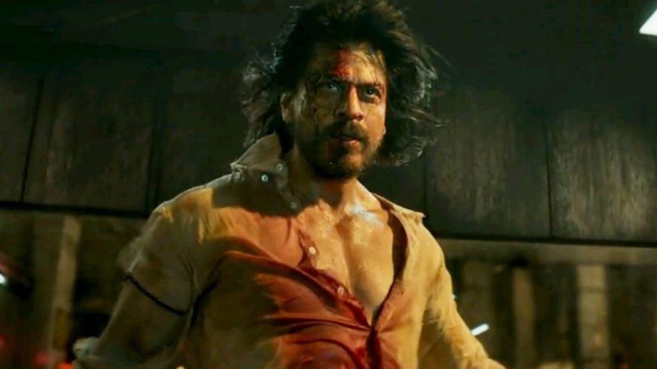 Shah Rukh Khan Meets With An Accident On The Sets In LA, Undergoes A Surgery