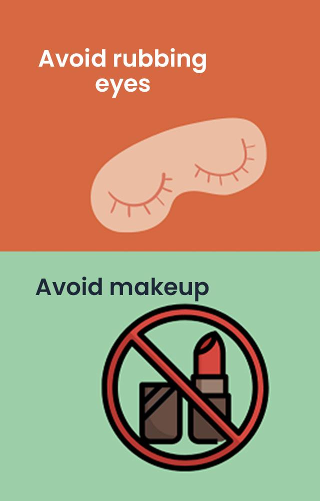 Tips that can help manage Conjunctivitis