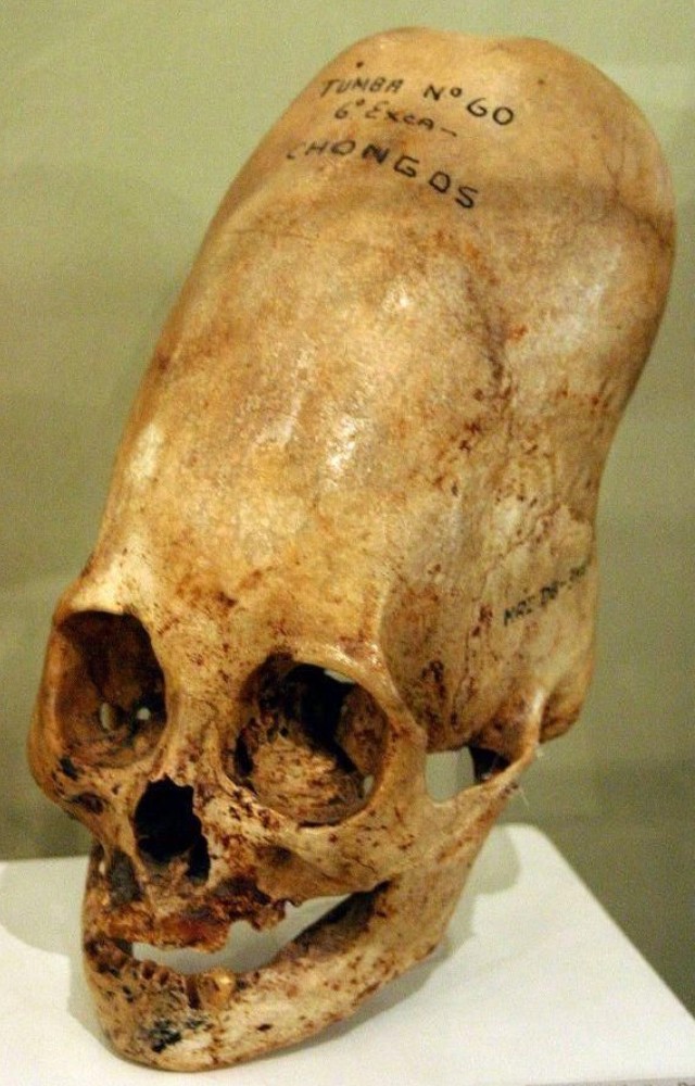 Graves in Paracas contained skulls with extreme elongation. Some believe it was ritual, others suspect unknown human variations—or even aliens.
