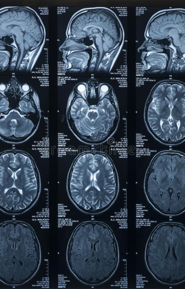 Magnetic Resonance Imaging relies on quantum spin properties of atoms. This medical tech helps detect tumors, brain injuries, and organ issues.
