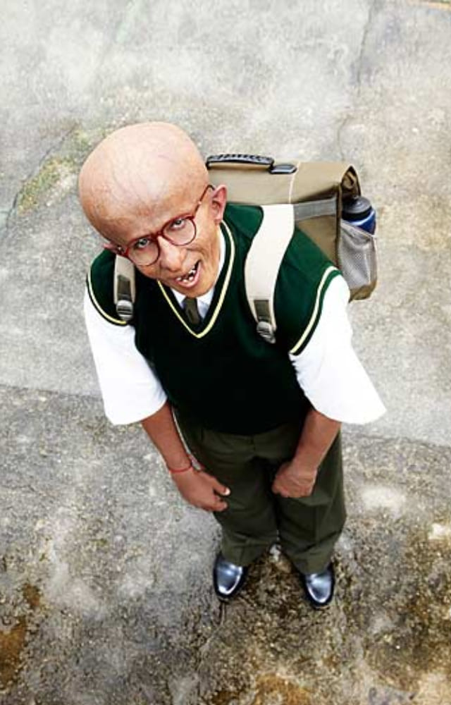 Even if prosthetics were a huge thing, it became popular with Amitabh Bachchan donning the role of a 12-year-old with a rare genetic disorder.