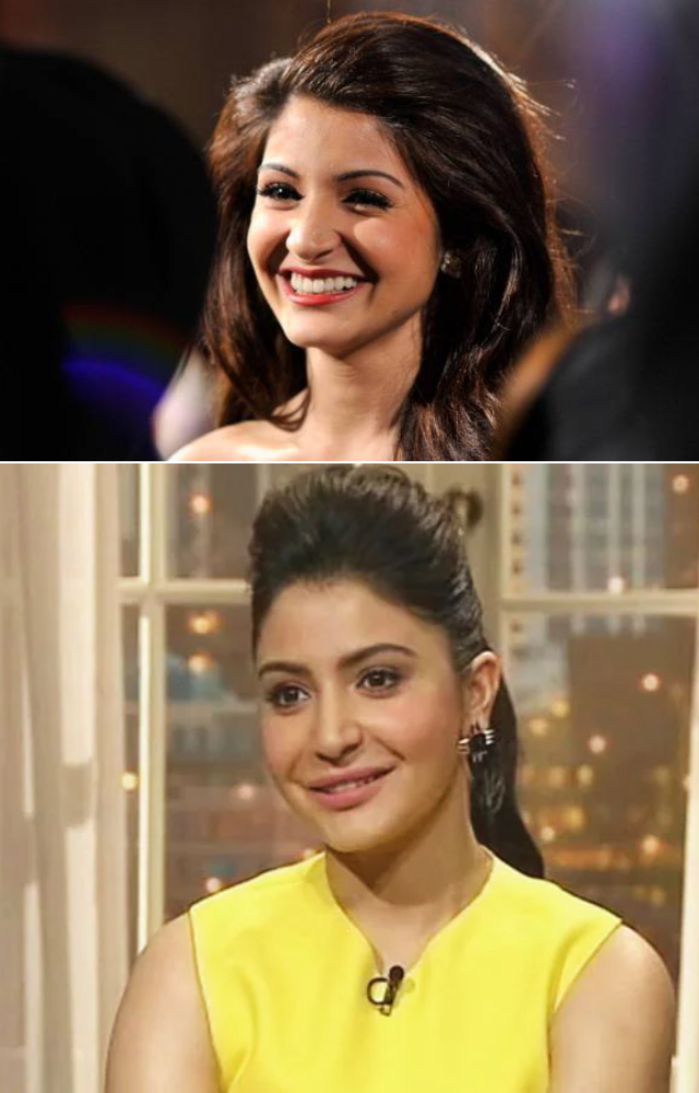 The Band Baaja Baarat actress left her fans stunned after her new look with lip fillers and cheek implants went viral on Koffee With Karan.