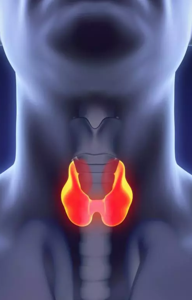 Risk factors include family history, being female, age (30–50), high iodine intake, and exposure to radiation or toxins.