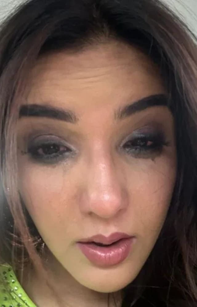 Jasmin revealed that she had worn lenses for an event in Delhi, after which her eyes started hurting, and the pain got worse. She couldn`t see anything.