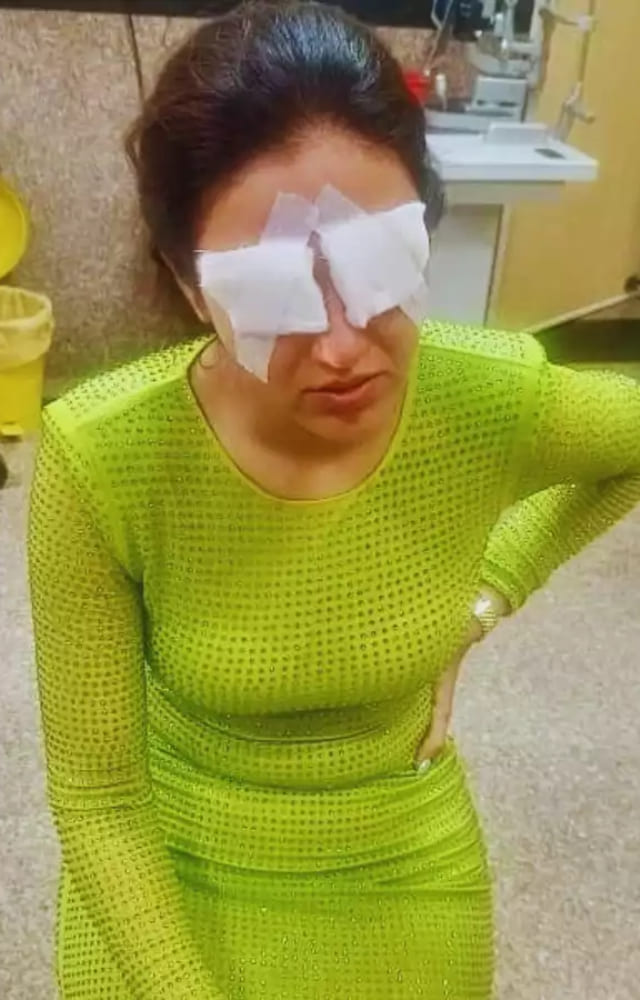 Television actress and Bigg Boss fame Jasmin Bhasin has revealed that she suffered from a severe eye injury that damaged her cornea.