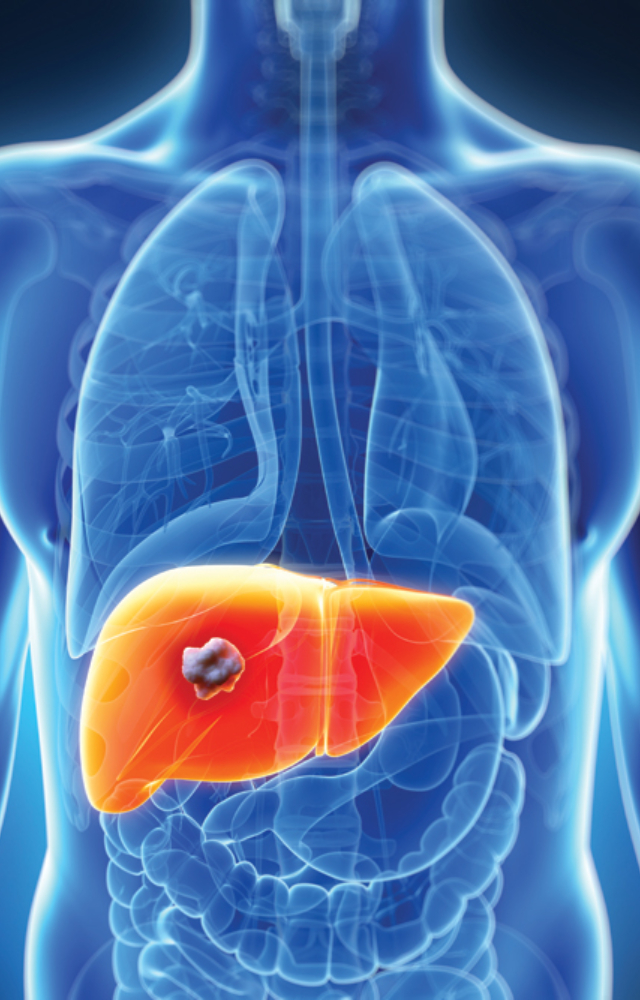 Let`s understand more about Dipika Kakar`s diagnosis, types of liver tumors, their symptoms, and foods that promote a healthy liver.