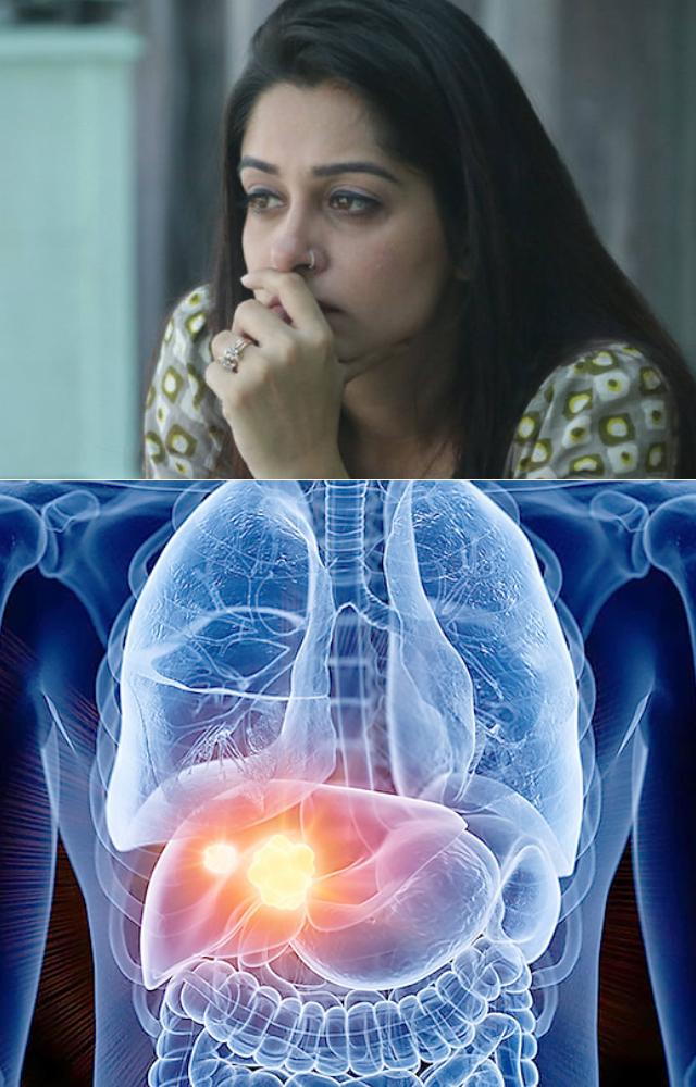 What Is Liver Tumor? Signs And Symptoms