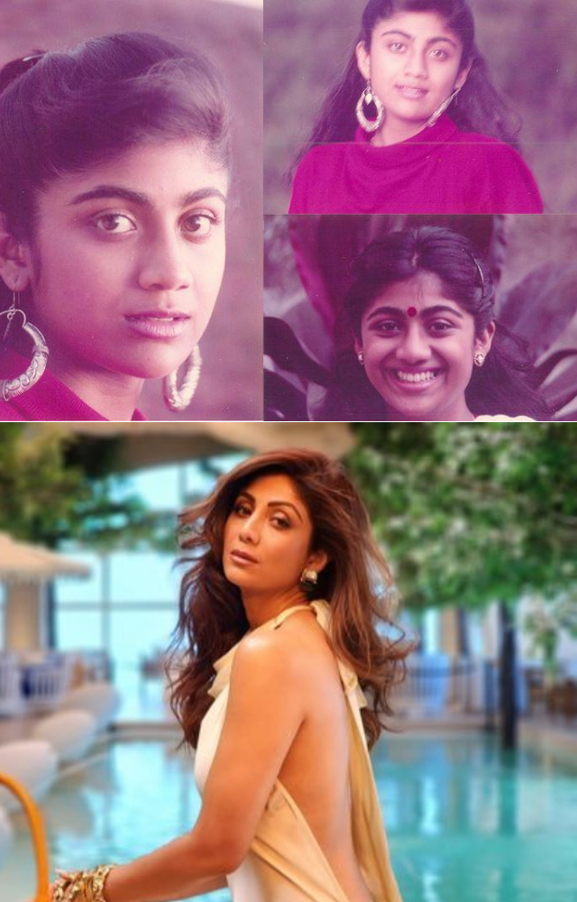 The Dhadkan actress is frequently mentioned in discussions about cosmetic surgeries, including lip fillers and rhinoplasty.