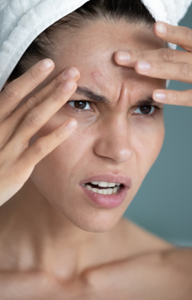 Conditions like eczema, psoriasis, and rosacea have been linked to an unhealthy gut. Inflammation in the gut can often manifest on the skin.