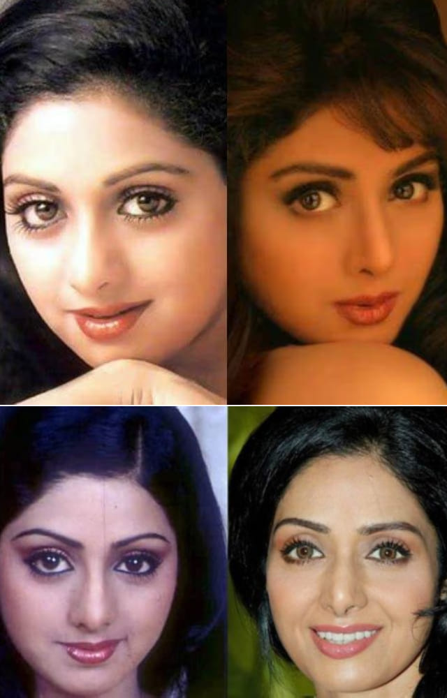 The legendary late actress had undergone nose surgery to enhance her appearance. Although she never confirmed nor denied, experts claim a notable difference.