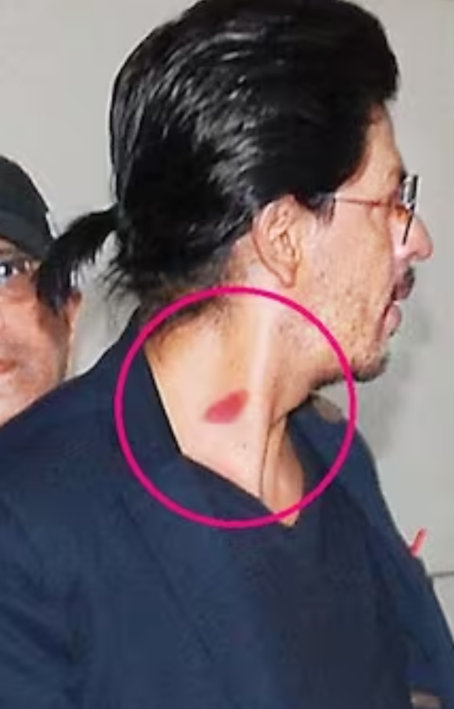 Don`t let your fantasies run wild because Shah Rukh got the love bite during a fight scene in a pub, or peripheral During the Dilwale sets, SRK shared a picture