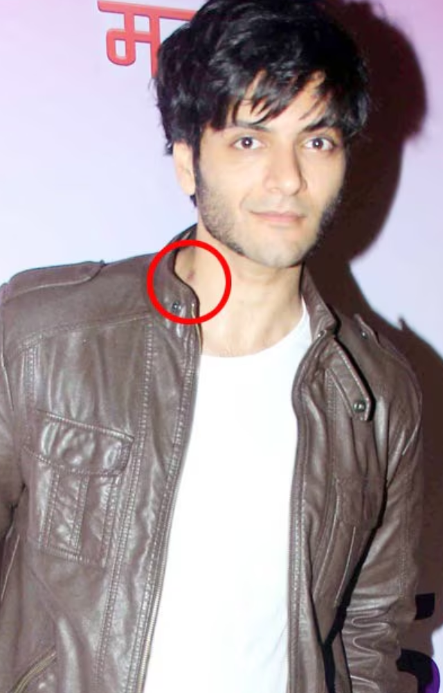 At a function, Ali Fazal was seen showing off a hickey around his neck, and he didn`t appear to be at all self-conscious about it.