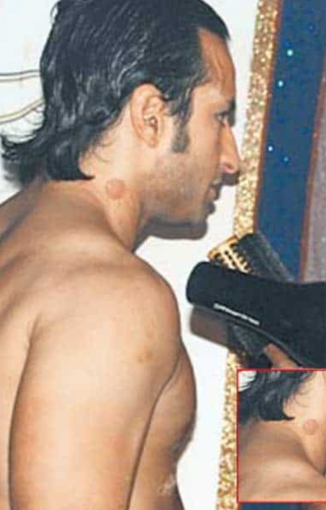 When someone took a photo of Saif Ali Khan at a party backstage, it went viral. Saif had a love bite on his neck when it was discovered.