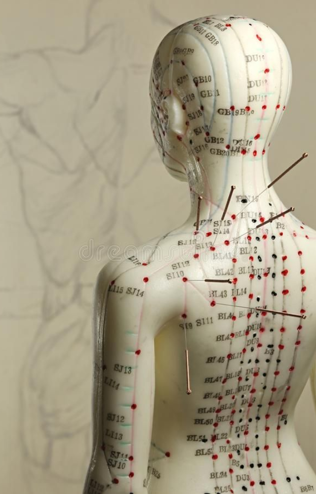 This Chinese technique restores energy flow and relieves pain using fine needles on specific body points and has been practiced for over 2,000 years.
